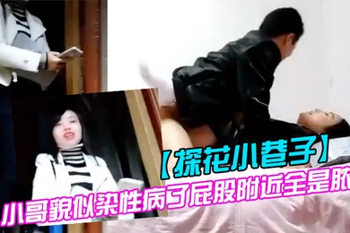 探花小巷子大粗屌农村小伙县城小巷子底层嫖妓连搞两个站街卖淫女小哥貌似染性病了屁股附近全是脓疮